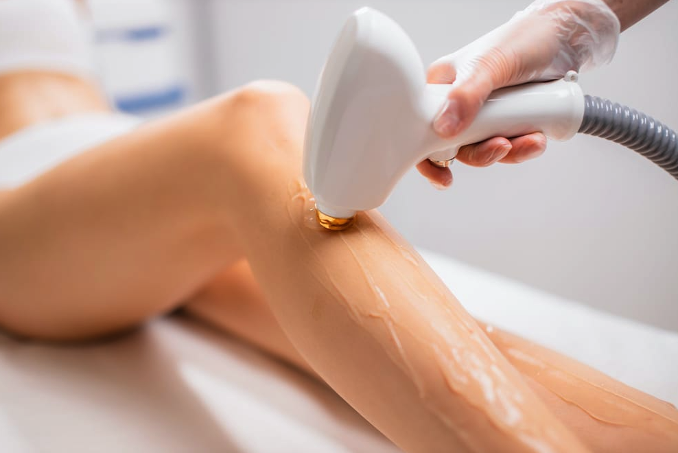 Frequently Asked Questions About Laser Hair Removal In Ottawa