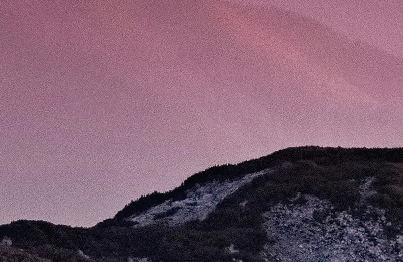 PRP (Platelet-Rich Plasma)