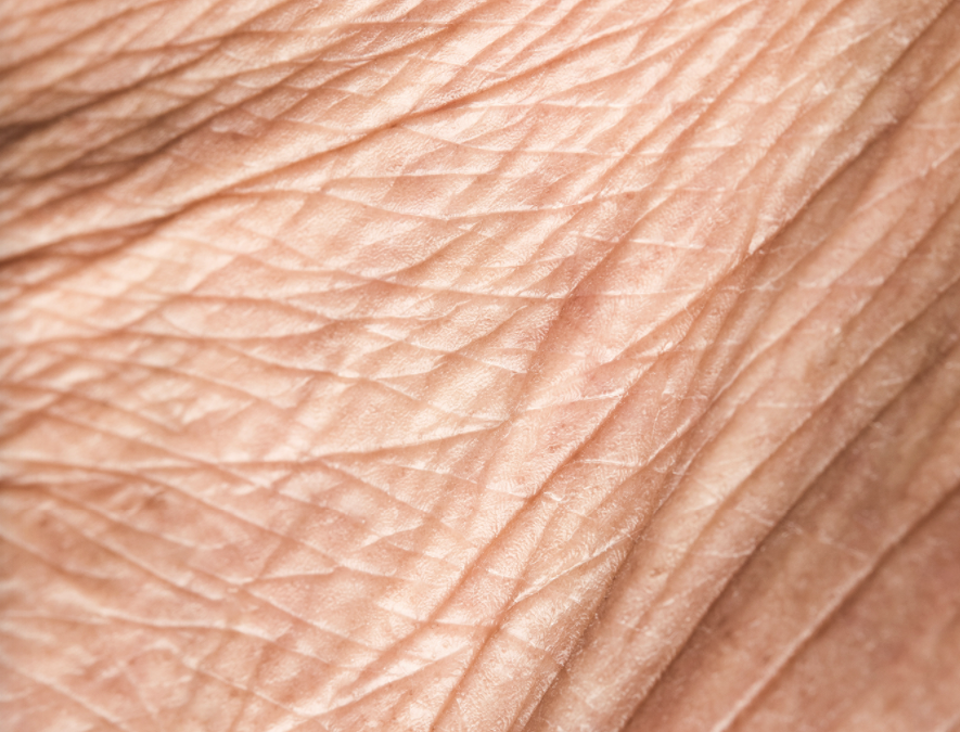 Different types of wrinkles and how to treat them